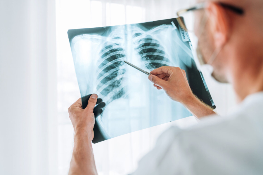 Hipertensão pulmonar: falta de ar e cansaço podem esconder doença grave e silenciosa
